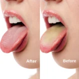 LIMETOW™-Tongue-Cleaner9