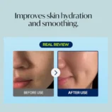 Results_Torriden_Dive-In_Low_Molecule_Hyaluronic_Acid_Mask_Set