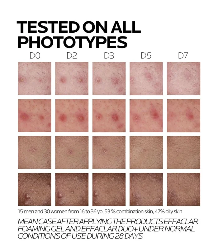 lrp-effaclar-duo-m-pdp-diversity