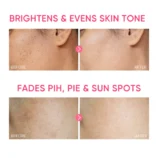 my-11134207-7r98q-lmsu5pz6uwt2c2