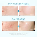 my-11134207-7r98q-lpol88x6khnr18