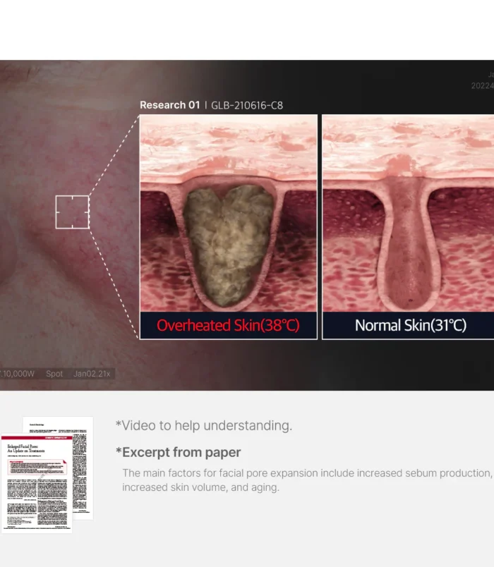 4_d886904a-6530-42a6-b1e8-1acf04e95787