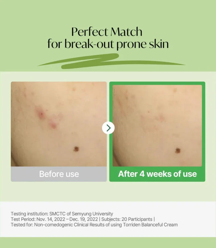 R_Torriden_Balanceful_Cica_Soothing_Cream_80ml