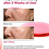 anua-ampoule-serum-30ml-niacinamide-10-txa-4-serum-1130199714