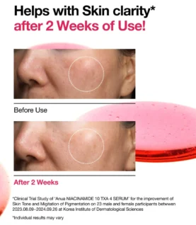 anua-ampoule-serum-30ml-niacinamide-10-txa-4-serum-1130199714