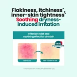 dr-g-global-moisturizers-creams-dr-g-r-e-d-blemish-clear-moisture-cream-42492708192508