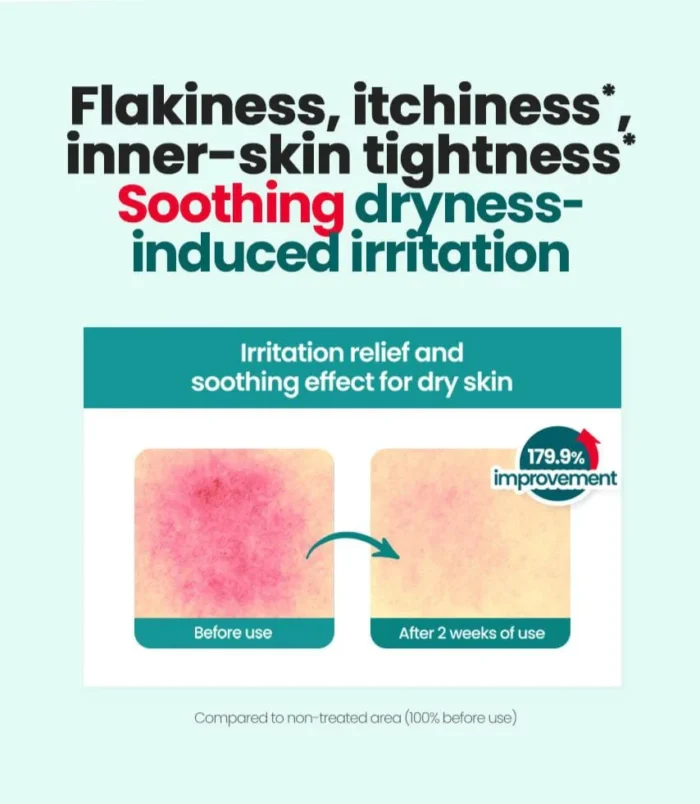 dr-g-global-moisturizers-creams-dr-g-r-e-d-blemish-clear-moisture-cream-42492708192508 dr-g-global-moisturizers-creams-dr-g-r-e-d-blemish-clear-moisture-cream-42492708192508