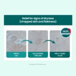 dr-g-global-moisturizers-creams-dr-g-r-e-d-blemish-clear-moisture-cream-42492708225276