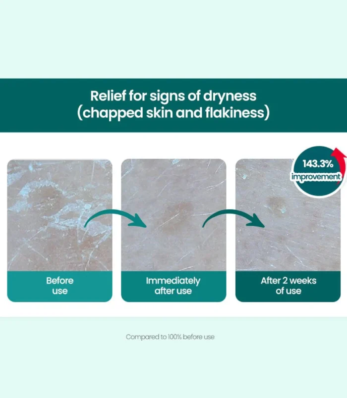 dr-g-global-moisturizers-creams-dr-g-r-e-d-blemish-clear-moisture-cream-42492708225276 dr-g-global-moisturizers-creams-dr-g-r-e-d-blemish-clear-moisture-cream-42492708225276