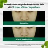 dr-g-global-moisturizers-creams-dr-g-r-e-d-blemish-clear-soothing-cream-70ml-43564905726204_1080x