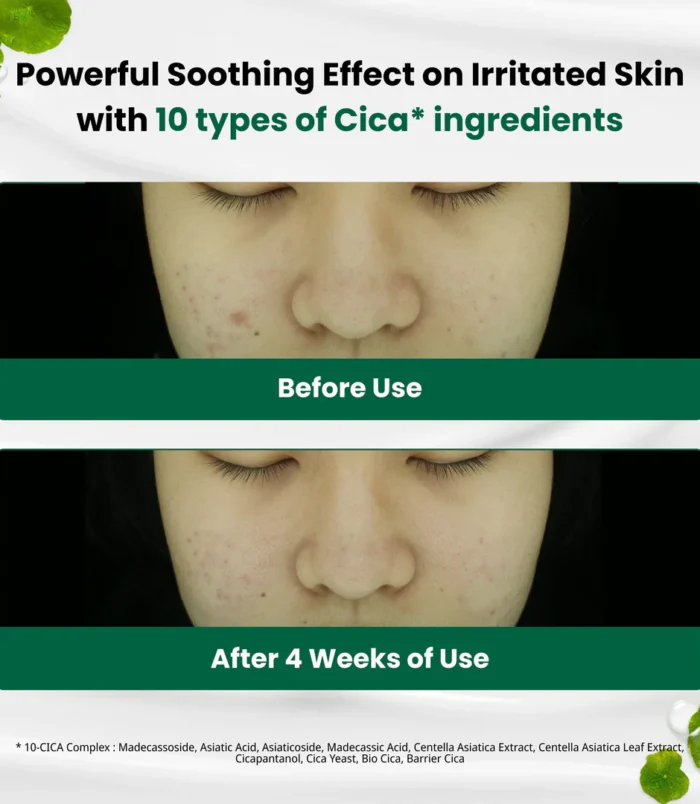 dr-g-global-moisturizers-creams-dr-g-r-e-d-blemish-clear-soothing-cream-70ml-43564905726204_1080x dr-g-global-moisturizers-creams-dr-g-r-e-d-blemish-clear-soothing-cream-70ml-43564905726204_1080x