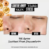 calendula-herbal-extract-alcohol-free-toner-en-4.jpg@0