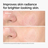 ord-alpha-arbutin-before-after-brighter-skin