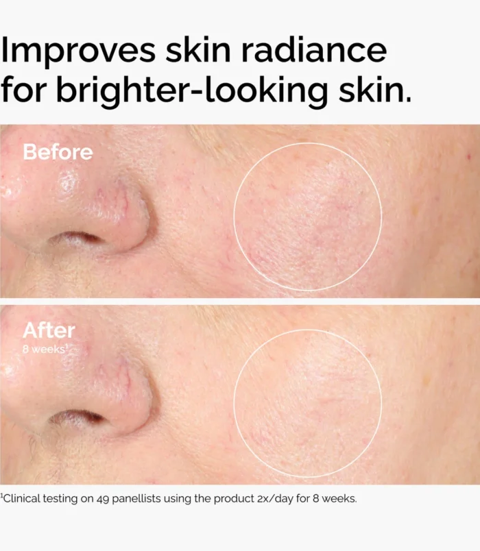 ord-alpha-arbutin-before-after-brighter-skin